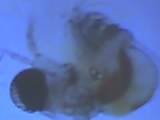 Ett kvalster