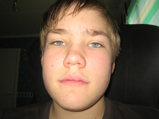 Bild av hermesaken