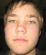 Bild av hermesaken
