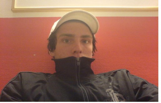Bild av sundbrandt