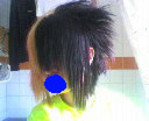 Bild av Fnexblubb