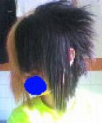 Bild av Fnexblubb