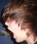 Bild av CarnalDisfigurement
