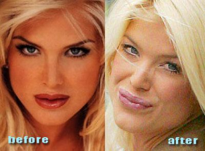 Bild av playboy_kanin