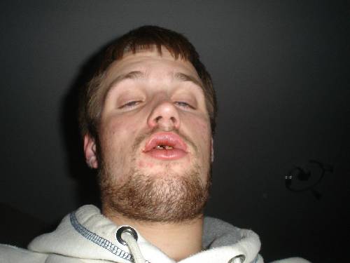 Bild av broo