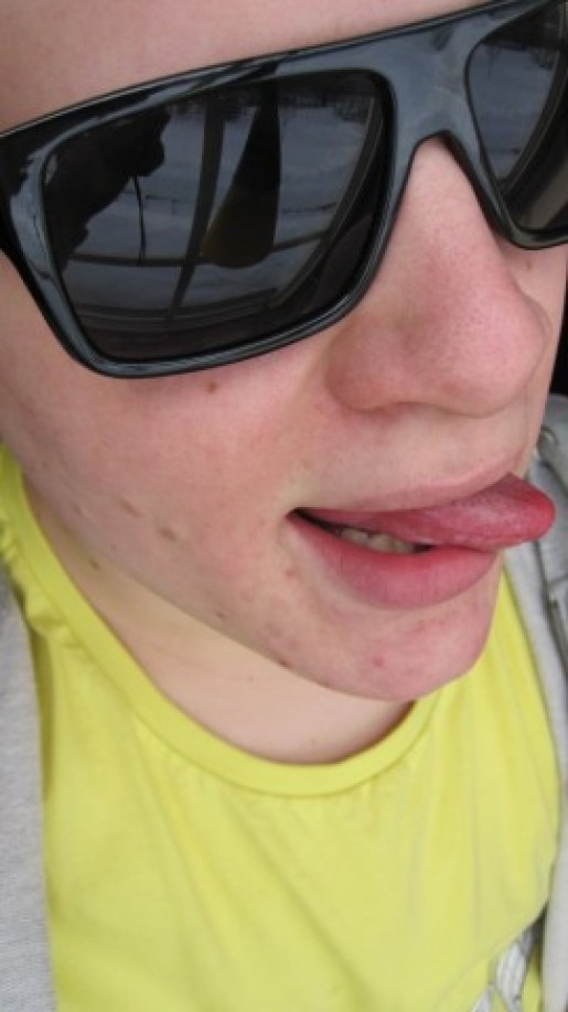 Bild av xyppi