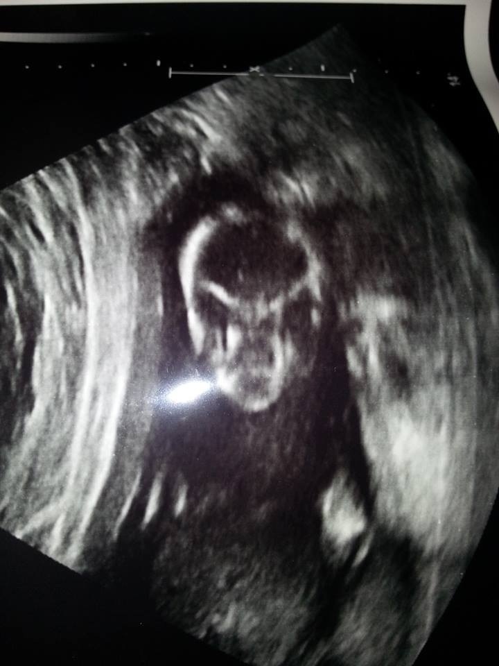 Alienbaby