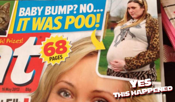 Baby bump