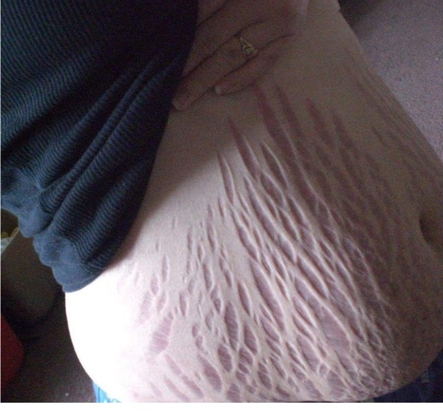 Graviditet gone wrong