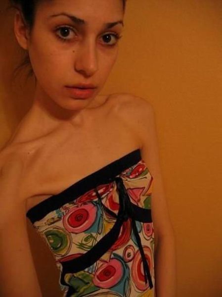 Tjejer med anorexia – bild 19 av 44