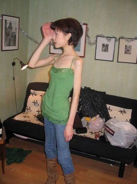 Tjejer med anorexia – bild 20 av 44
