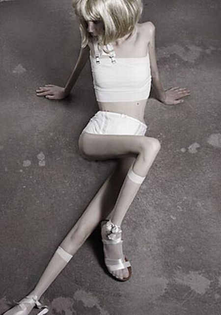 Tjejer med anorexia – bild 34 av 44