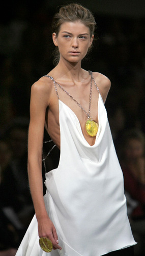 Tjejer med anorexia – bild 41 av 44