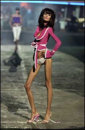 Tjejer med anorexia – bild 44 av 44
