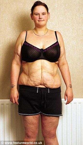 Från fetman till anorexia – bild 4 av 10