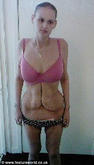 Från fetman till anorexia – bild 6 av 10