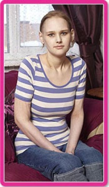 Från fetman till anorexia – bild 8 av 10