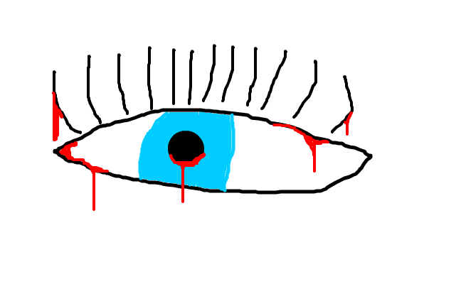 Crying Blood!