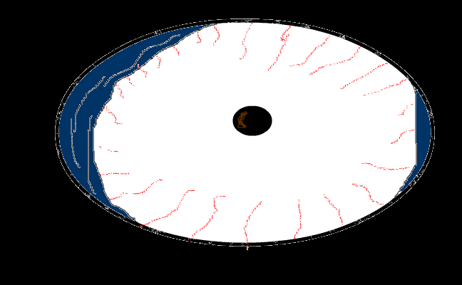 the eye