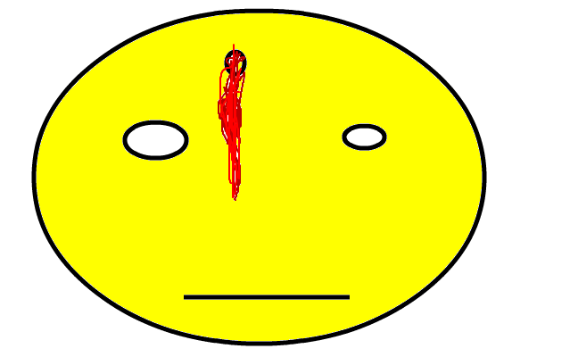 asd