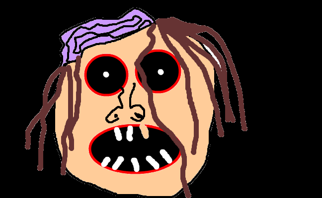 Brain damage