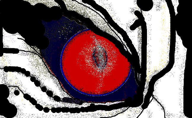 Evil eye