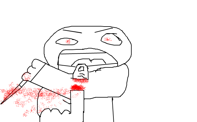 WTFmy finger