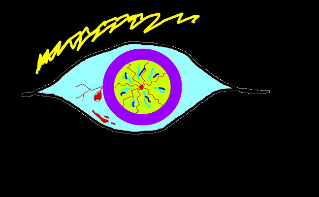 blood eye