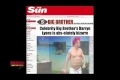 Bild från Fettsug fram ett sexpack